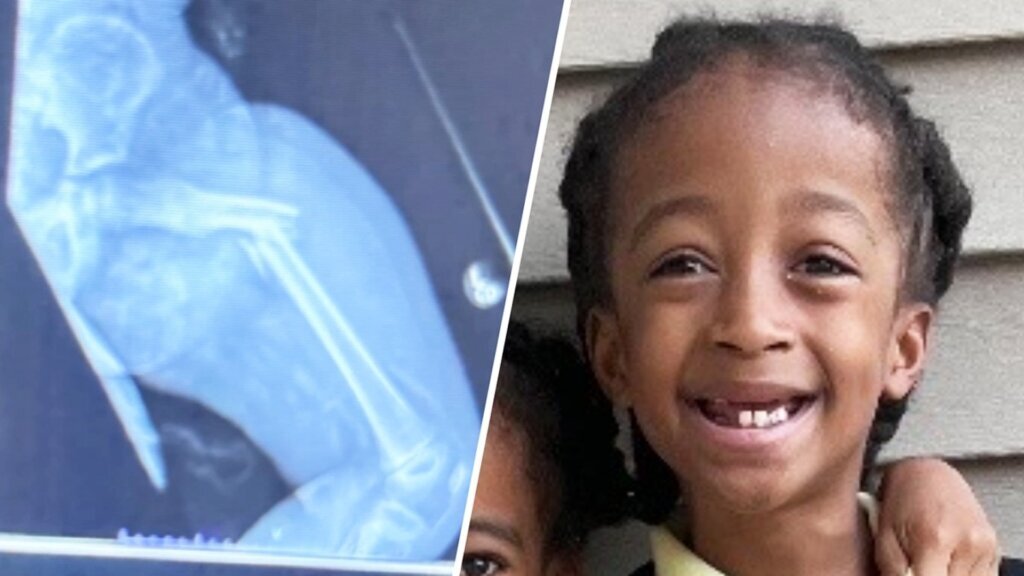 Family wants answers on how 7 year old fractured femur in Hyattsville classroom