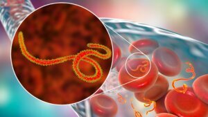 Ebola,Viruses,In,Blood,Of,A,Patient,With,Ebola,Hemorrhagic